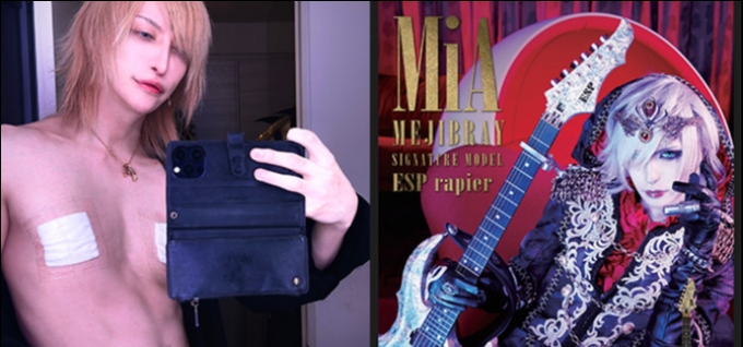 Gitaris Jepang MiA Viral Karena Operasi Menghilangkan Puting