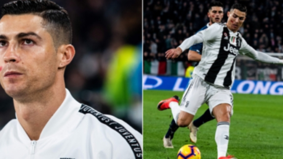 Kenapa Terdapat Coretan Merah di Pipi Cristiano Ronaldo dan Beberapa Pemain Serie A Lain?