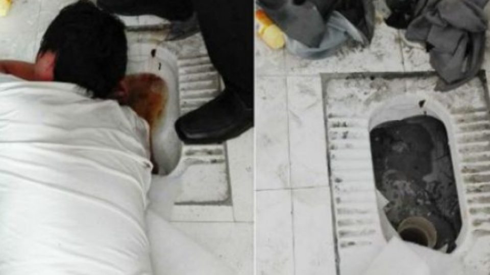 Miris! Demi Selamatkan iPhone, Tangan Pria Ini Terjebak di Kloset