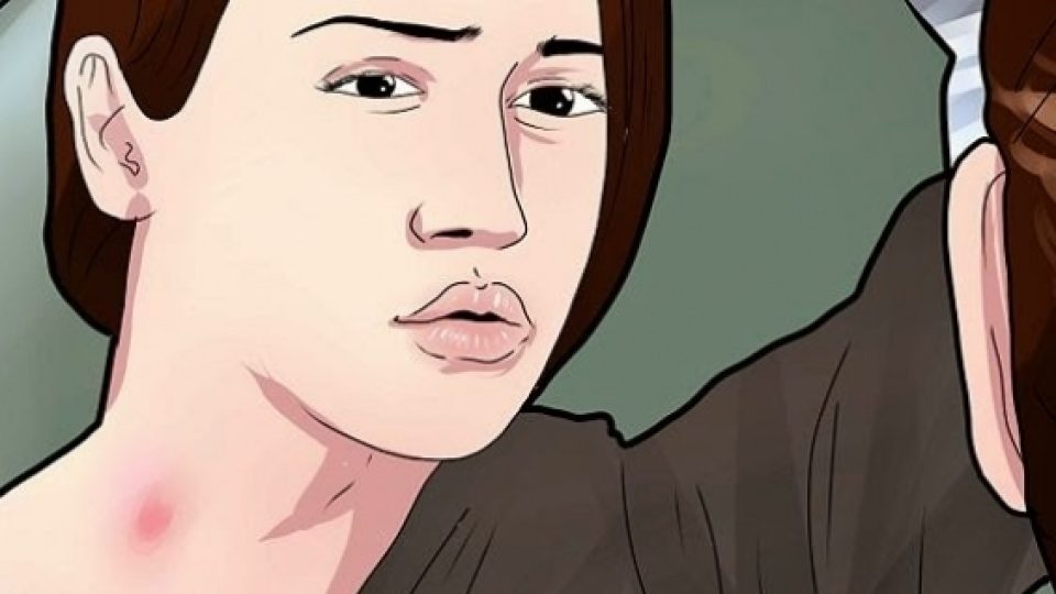 Remaja Terkena Stroke Setelah Di Cupang Pacar