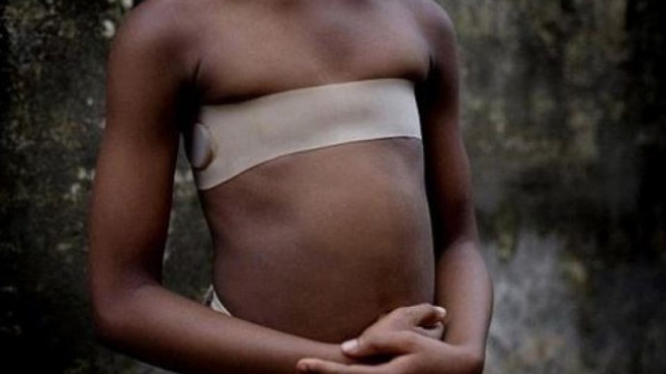 Ini Alasan Wanita di Afrika Setrika Payudaranya Dengan Batu Panas