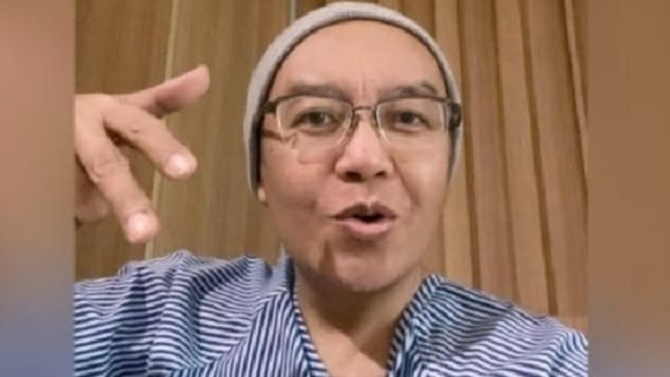 Ari Lasso Akui Sakit Kanker dan Jalani Kemoterapi, Berkelakar Kini Gundul Seperti Ahmad Dhani dan Deddy Corbuzier