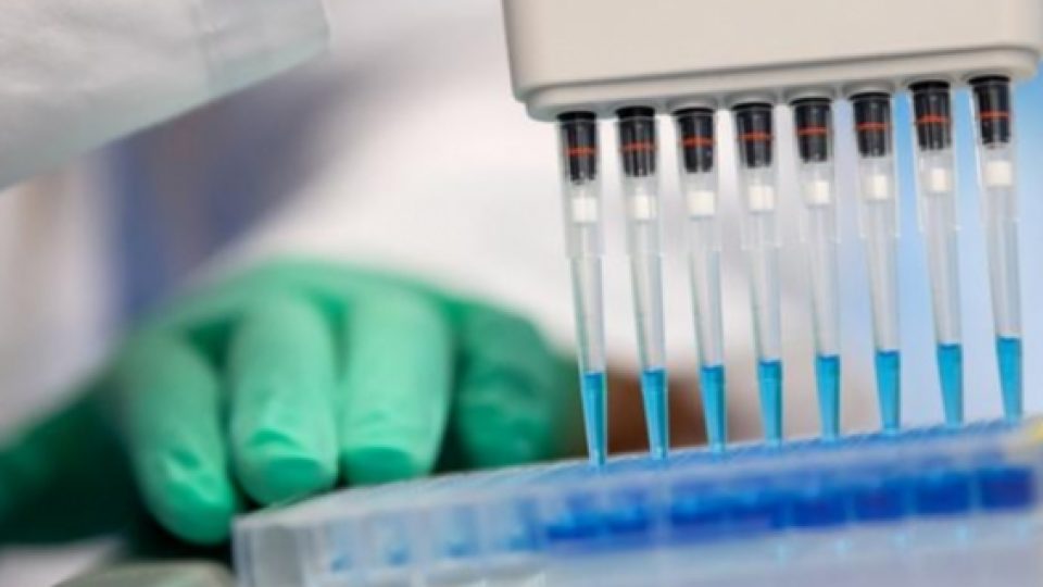 Jerman Setujui Uji Coba Vaksin Virus Corona Terhadap Manusia