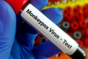 9 Suspek Cacar Monyet di Indonesia Sudah Berstatus 'Discarded' Alias Negatif Cacar Monyet