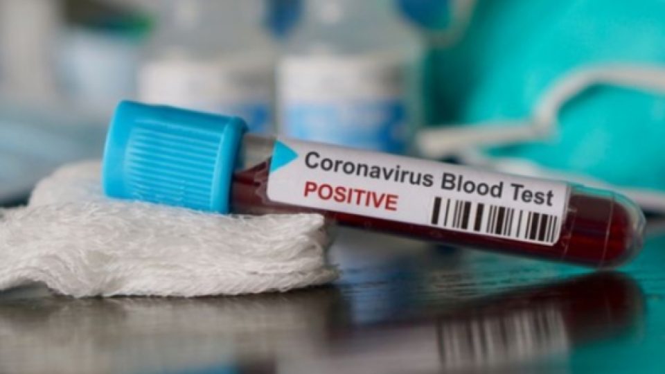 Mengenal Rapid Test Massal yang Dipilih Pemerintah Untuk Tangkal Wabah Corona