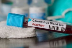 Mengenal Rapid Test Massal yang Dipilih Pemerintah Untuk Tangkal Wabah Corona