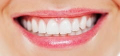 Cara Mudah Memutihkan Gigi