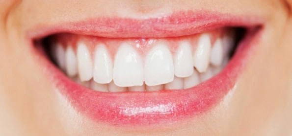 Cara Mudah Memutihkan Gigi