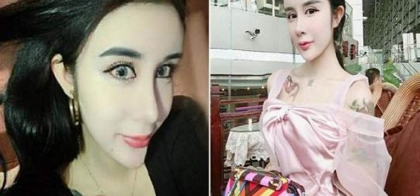 Setelah Operasi Wajah, Wanita Ini Seperti Menggunakan Topeng